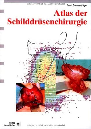 Atlas der Schilddrüsenchirurgie: Ein chirurgisch-klinisches Lehrbuch cover image