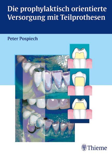 Die prophylaktisch orientierte Versorgung mit Teilprothesen, Peter Pospiech