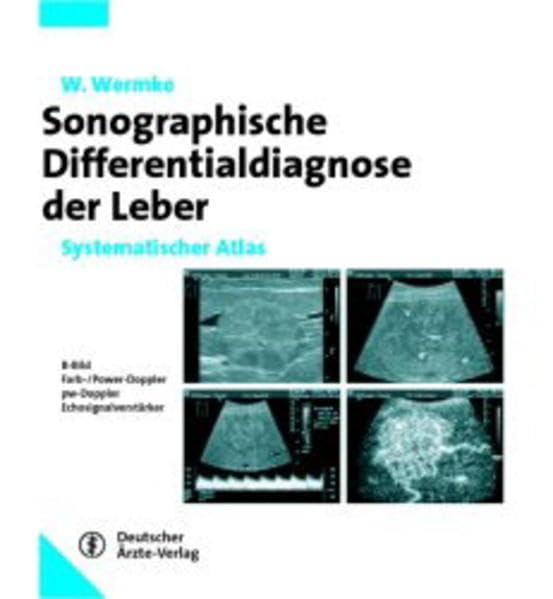 Sonographische Differentialdiagnose der Leber: Systematischer Atlas, Wolfgang Wermke