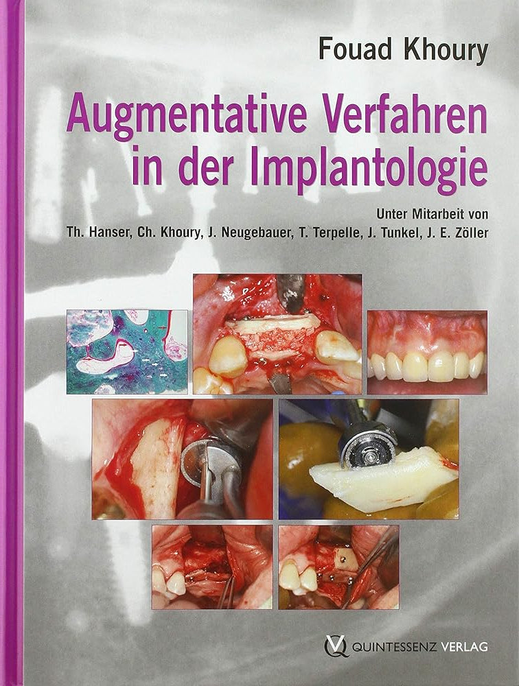 Augmentative Verfahren in der oralen Implantogie cover image