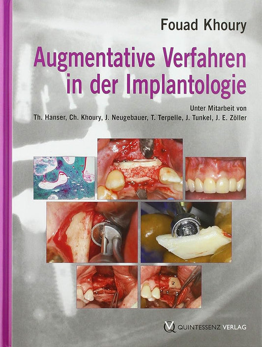 Augmentative Verfahren in der oralen Implantogie cover image