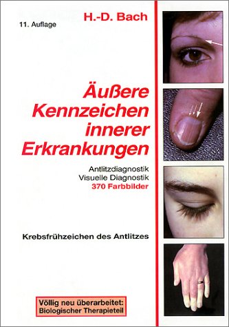 Antlitzdiagnostik: Äußere Kennzeichen innerer Erkrankungen, Bd. 1: Lehrbuch und Farbatlas für Pathophysiognomie und visuelle Diagnostik, Hans-Dieter Bach
