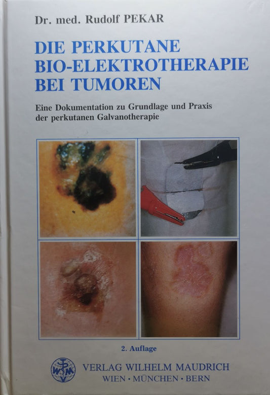 Die perkutane Bioelektrotherapie bei Tumoren: Eine Dokumentation zu Grundlage und Praxis der perkutanen Galvanotherapie, Rudolf Pekar