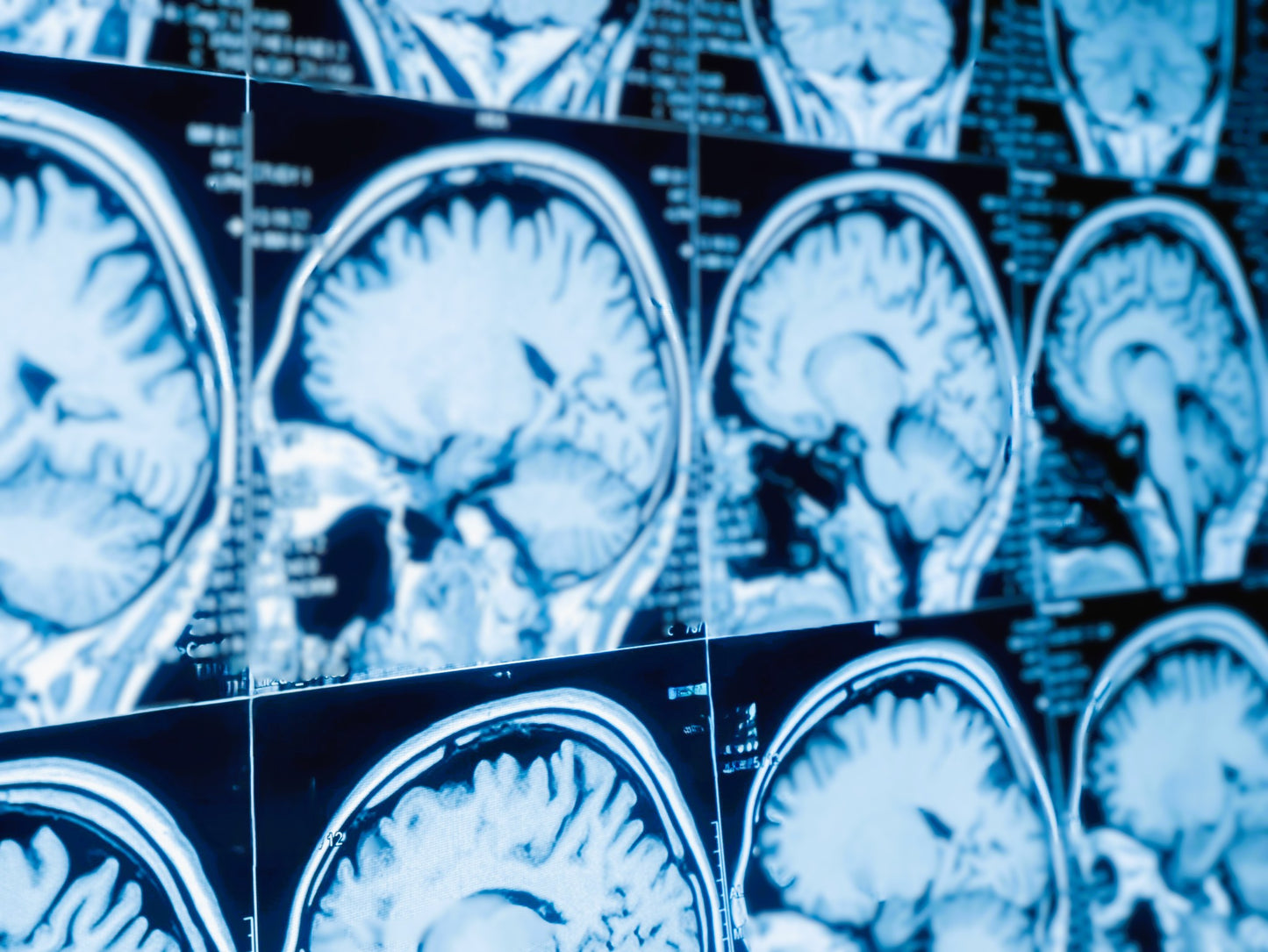 Neuroradiologie (Reihe, REF.-R. RADIOLOGIE), Michael Forsting, Olav Jansen, Klaus Sartor, Martin Bendszus, Ansgar Berlis