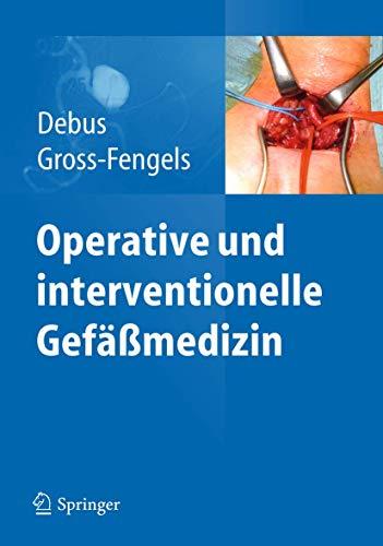 Operative und interventionelle Gefamedizin [Gebundene Ausgabe] Debus, Eike Sebastian und Gross-Fengels, Walter