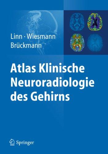 Atlas Klinische Neuroradiologie des Gehirns,  Linn / Wiesmann / Brückmann