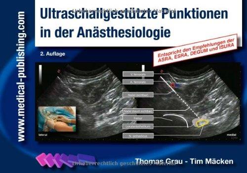 Ultraschallgestützte Punktionen in der Anästhesiologie [Spiralbindung], Thomas Grau und Tim Macken