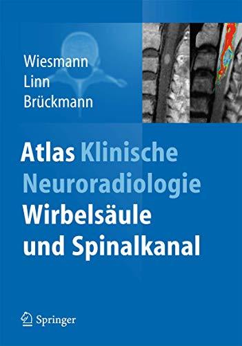 Atlas Klinische Neuroradiologie: Wirbelsaule und Spinalkanal [Gebundene Ausgabe] Wiesmann, Martin; Linn, Jennifer und Bruckmann, Hartmut