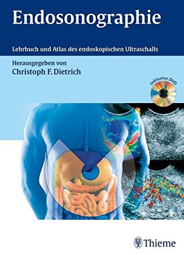 Endosonographie: Leitfaden und Atlas: Lehrbuch und Atlas des endoskopischen Ultraschalls; Christoph Frank Dietrich